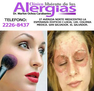 URTICARIA POR CONTACTO ALERGICA A COSMETICOS.